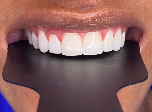 Slider image (5) Dra. Faneris Urrutia